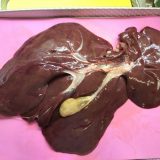 ブタの肝臓の観察