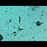 水生微生物と一緒に泳いだらどんな感じ？微生物あふれる水中を360°観察できる画期的映像