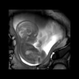 21週目の胎児をMRIで撮影してみたらめちゃくちゃ動いていた！