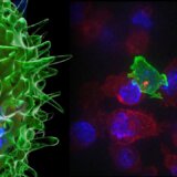 キラーT細胞とナチュラルキラー（NK）細胞の違いとは？