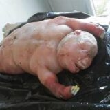 【閲覧注意】妊娠中のリフトバレー熱ウィルス感染によってヒトみたいになったヒツジの胎児【画像】