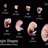 【閲覧注意】ヒトの胎児画像