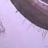 【マニアック】クラゲの刺胞から棘が飛び出るスローモーション映像が一部の人には感動的