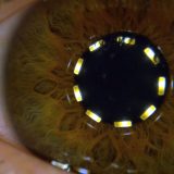 たばこの吸いすぎ(おそらく発癌)によって喉頭全摘出した女性が訴える禁煙の勧め