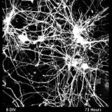 神経細胞が軸索をうにゃうにゃ伸ばしてシナプスを形成する様子を観察してみた