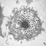 【Q＆A】ウィルスは光学顕微鏡で観察できる？