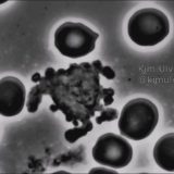 血液を顕微鏡で観察してみたら活発にアームを伸ばす白血球を見つけた！