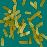 【緑膿菌感染症】感染すると膿が緑色になる緑膿菌とは？