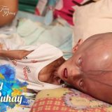 フィリピンで生まれた水頭症の赤ちゃんとお母さんの日常を撮影してみた