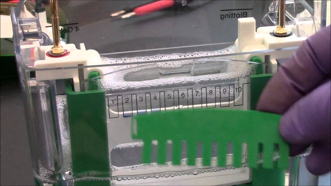 UPEP テストの準備と完了