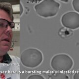 【動画】ヒト赤血球に侵入するマラリア原虫の様子を捉えた映像