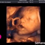 【動画】膣から直接音楽を聴かされている赤ちゃんの映像