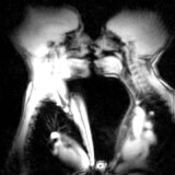 【動画】MRIでキスしている様子を撮影してみたら心臓の鼓動まで丸見えだった